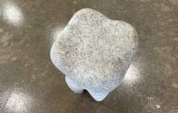 granit tand
